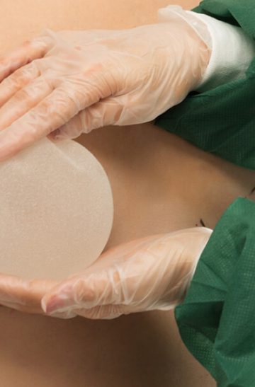 Anatomical_Implants