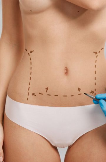 liposuccion-aesthetics-clinique