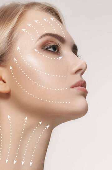 Lifting_du_visage