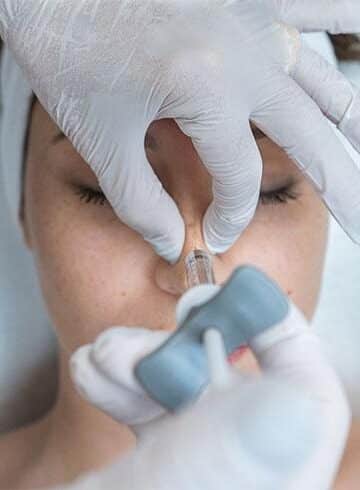 rhinoplastie
