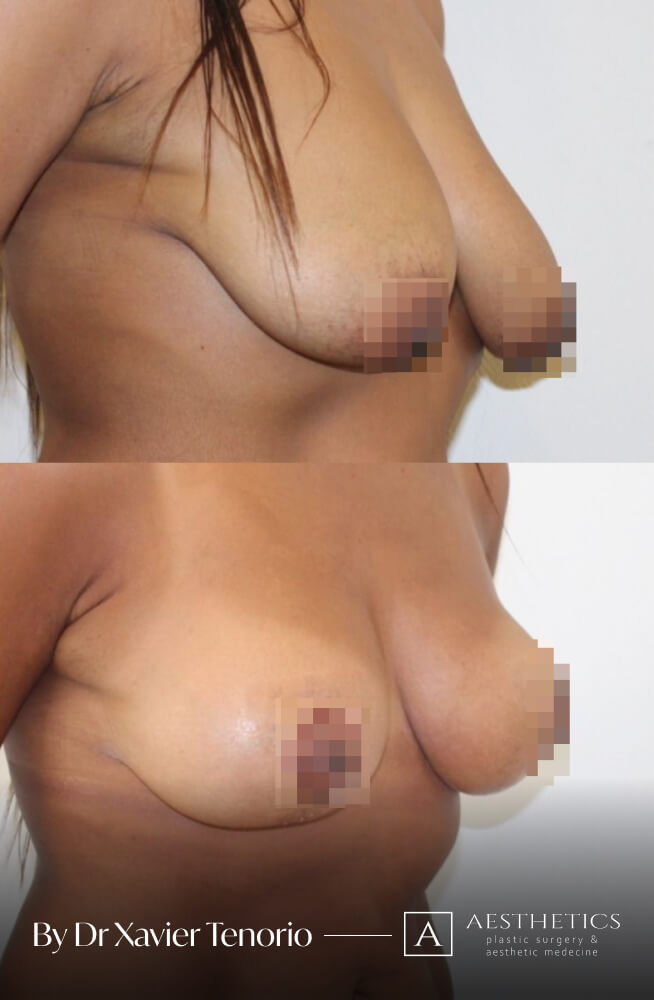 50