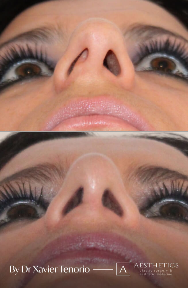 202