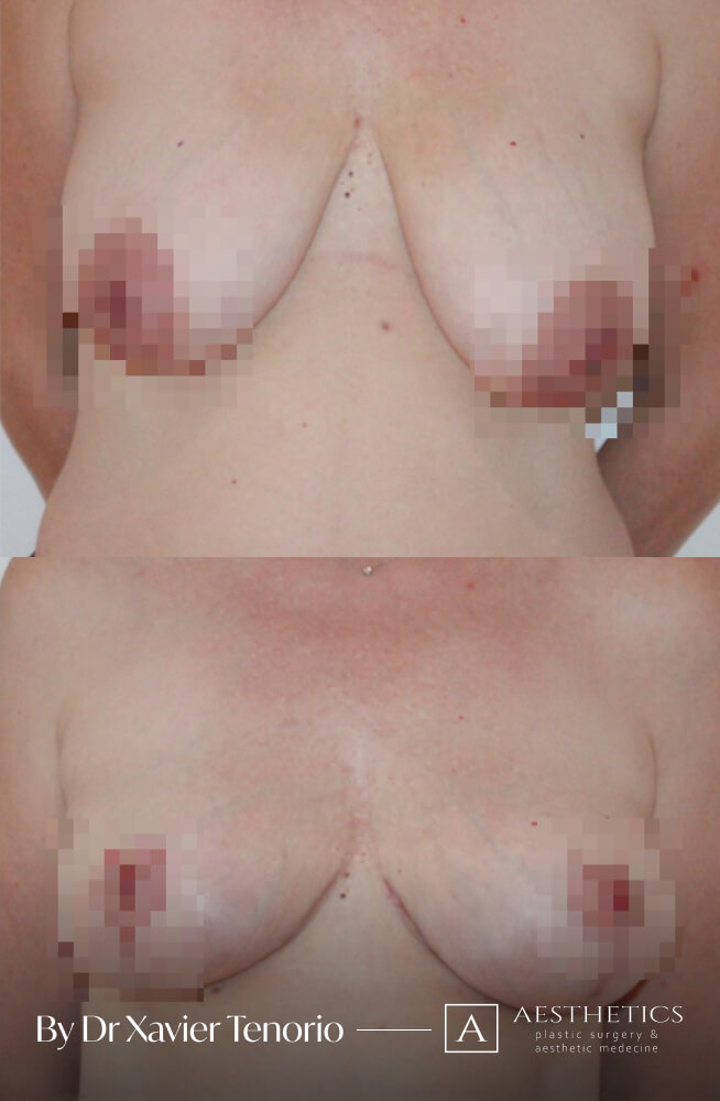 30