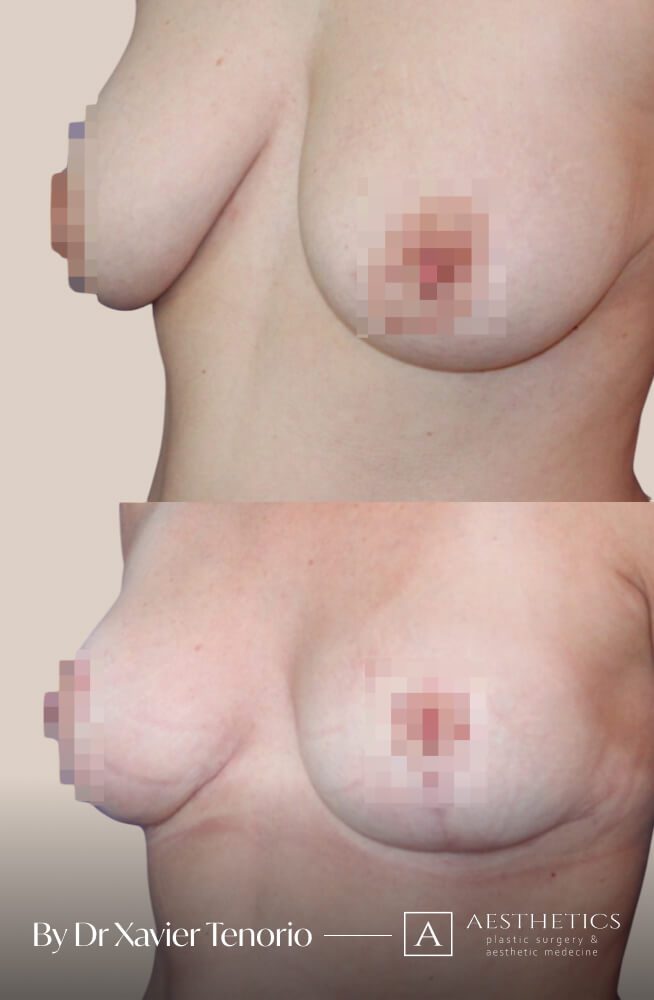 36